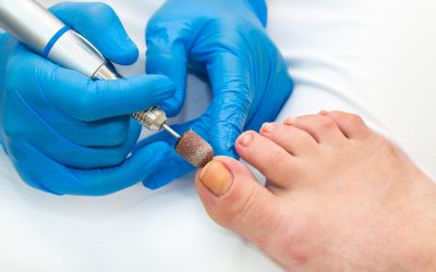 Exceptional Podiatric Services for Optimal Foot Health Provided by a Leading Foot Doctor in West Palm Beach, FL