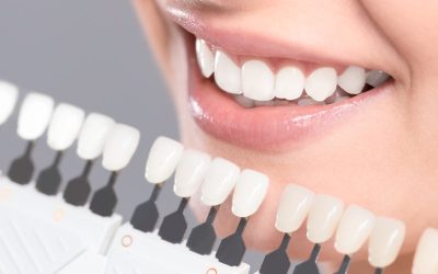 Achieve Natural Looking Results Through Cosmetic Dentist Services Clinton MS Smile Solutions