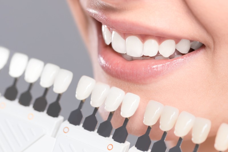 Achieve Natural Looking Results Through Cosmetic Dentist Services Clinton MS Smile Solutions