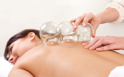 Experience Wellness Benefits With a Skilled Cupping Massage Therapist Oakland CA Residents Trust