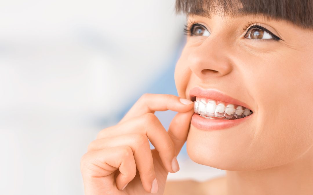 Getting Straighter Teeth Is Easy With Invisalign Clear Aligners Miami Orthodontists Recommend
