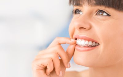 Getting Straighter Teeth Is Easy With Invisalign Clear Aligners Miami Orthodontists Recommend